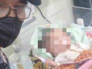 Ada Cairan di Kepala, Bayi Asal Cipaku Ciamis Butuh Bantuan IMG_20221204_062755_Fm3ckFum7J_fw83iDHP2i.jpeg