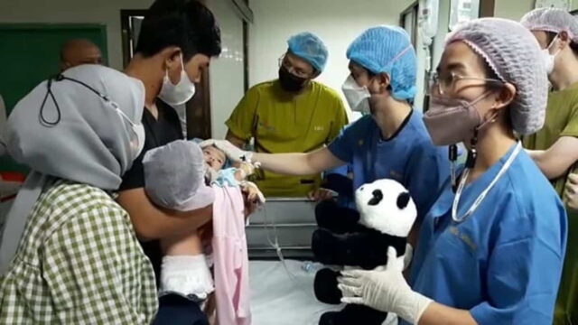 Operasi-Pemisahan-Bayi-Kembar-Siam.jpeg