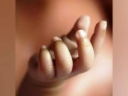 Jari Kelingking Bayi di Palembang Putus Tergunting Oknum Perawat, Begini Kronologinya Jari-Bayi-Putus.jpg