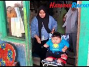 Pemkab Bekasi Tanggung Biaya Tindakan Medis Balita Obesitas balita-obesitas-di-bekasi.jpg
