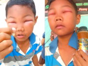 Mata Anak Ini Bengkak dan Sipit setelah Disengat Tawon, Netizen: Auto Jadi Oppa! Mata-Anak-Disengat-Tawon.jpeg