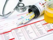 Pastikan Keselamatan Mudik Lebaran, PT KAI Daop 2 Bandung Lakukan Tes Urine Tes-Urine.jpg
