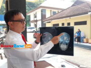 Dipukul Tongkat Baseball, Kepala Korban Penganiayaan di Kota Banjar Retak Kepala-Korban-Penganiayaan-di-Kota-Banjar.jpg