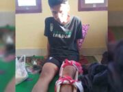 Seorang Aktivis HMI Patah Kaki Saat Demo Pemkot Tasikmalaya, Begini Kronologinya Patah-Kaki.jpg