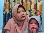 Cerita Safira, Anak Penderita Harlequin Ichthyosis yang Ditolak 2 TK di Tasikmalaya Safira-yang-ceria-bersama-ibunya.jpg