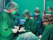 Senyum Baru dari Subang: RSUD Gelar Operasi Celah Bibir dan Palatum operasi celah bibir RSUD Subang